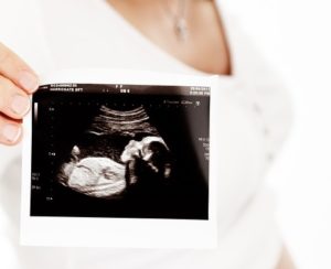 12-settimana-di-gravidanza-ecografia
