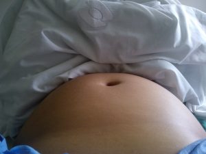 Amniocentesi-rischi